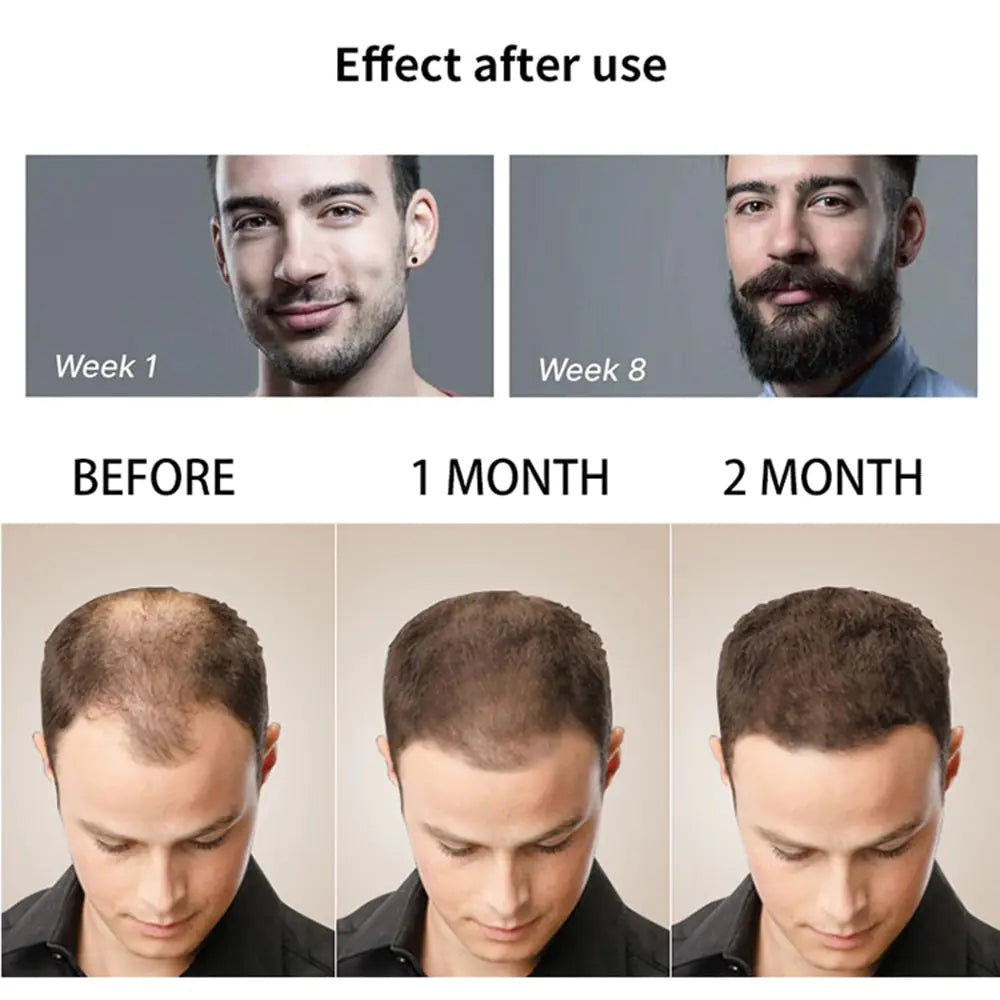 Beard Growth Oil: Activator Serum for Men